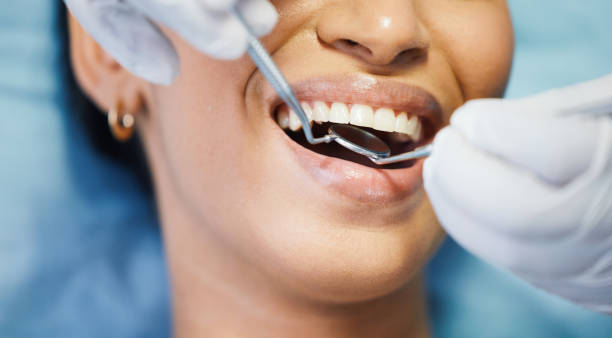 Best Cracked Tooth Emergency Dentist  in Minster, OH