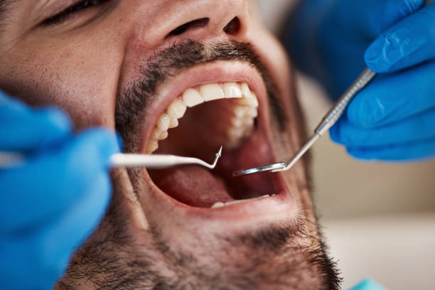 Best Tooth Infection Emergency Dentist  in Minster, OH