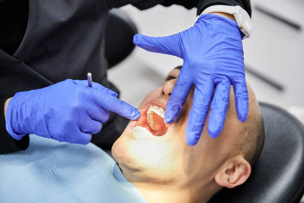 Best Root Canal Emergency Dentist  in Minster, OH